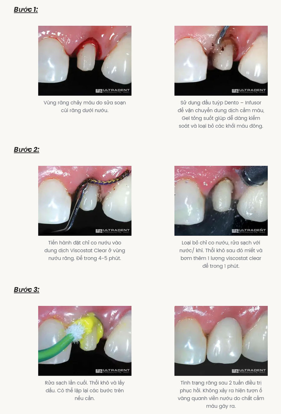 VISCOSTAT & VISCOSTAT CLEAR 3 use