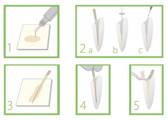 chất trám bít ống tủy gutta flow 2 & gutta flow bioseal 4 chat tram bit ong tuy gutta flow 2 and gutta flow bioseal