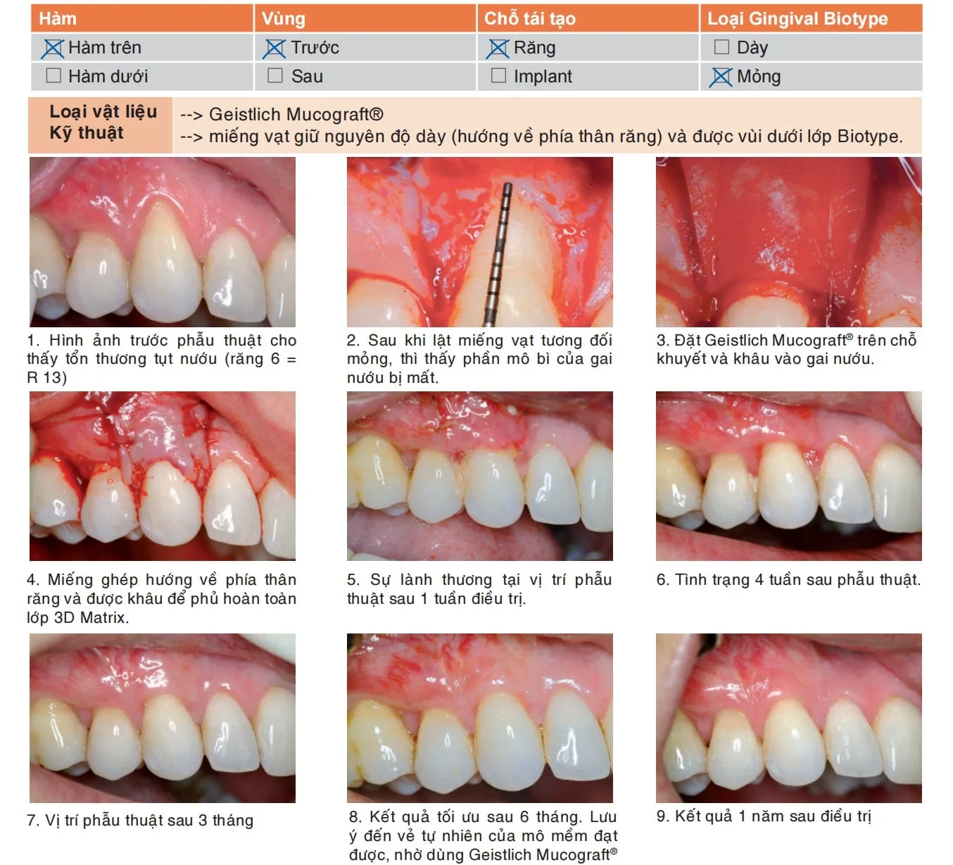 tai tao mo mem geistlich mucograft 2