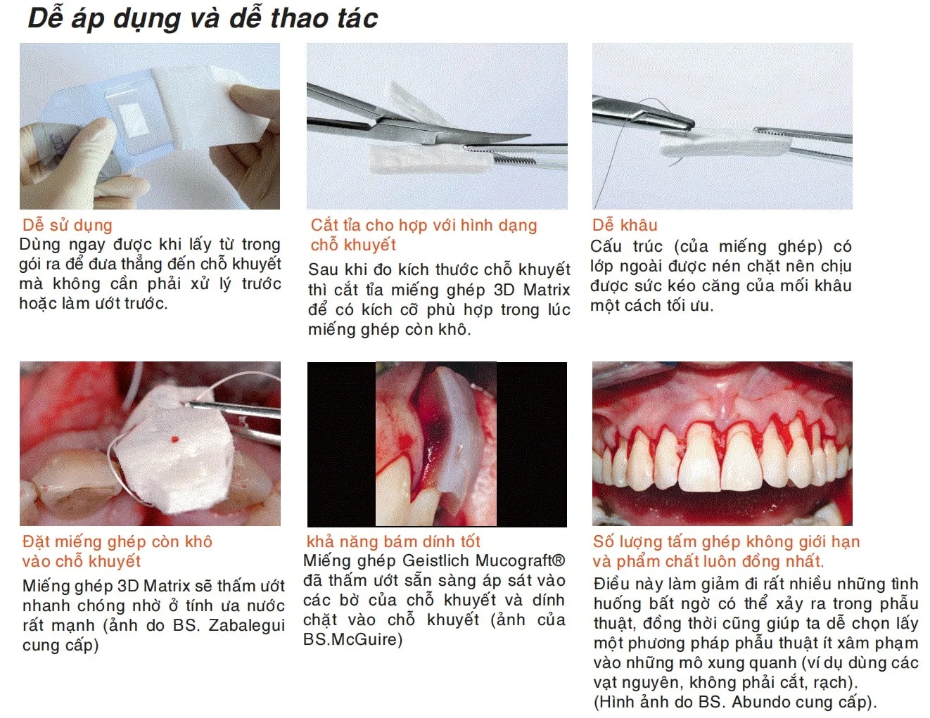 mucograft tái tạo mô mềm