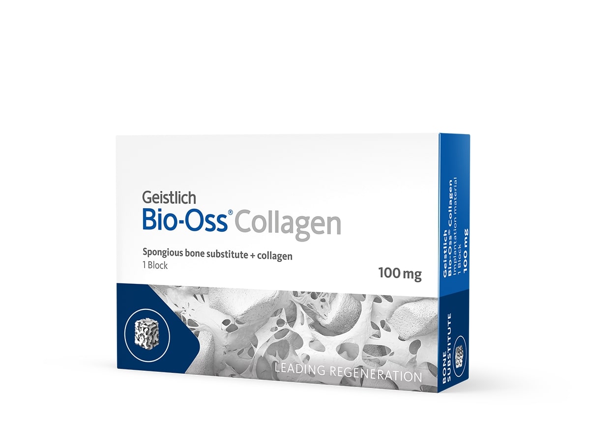 Bio-oss Collagen ghép xương ổ răng