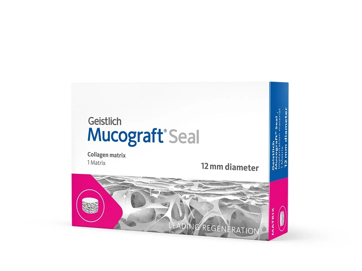 nút bảo vệ lỗ chân răng sau khi nhổ