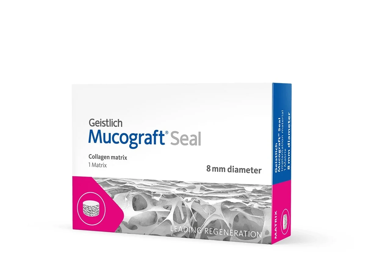 nút bảo vệ lỗ chân răng sau khi nhổ