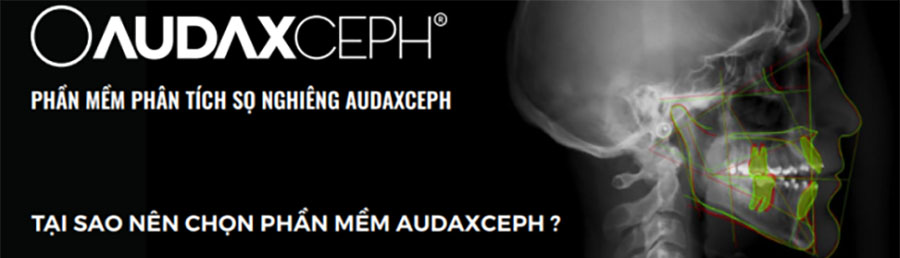 audax-ceph-1