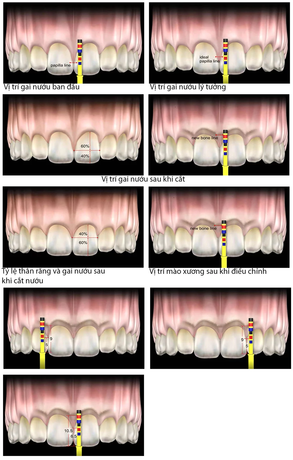 bộ dụng cụ thước đo thẩm mỹ của dr. chu 11 thuoc do tham my dr chu 10
