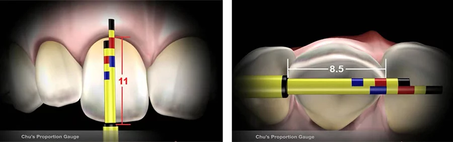 bộ dụng cụ thước đo thẩm mỹ của dr. chu 7 thuoc do tham my dr chu 11