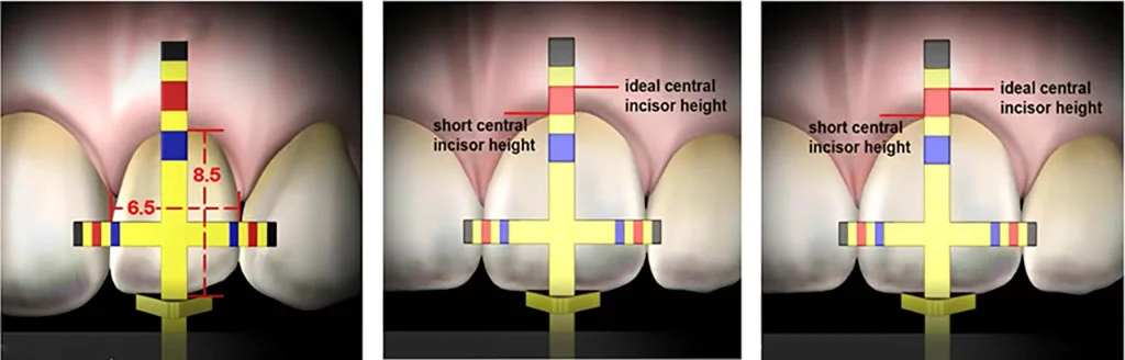 bộ dụng cụ thước đo thẩm mỹ của dr. chu 5 thuoc do tham my dr chu 5