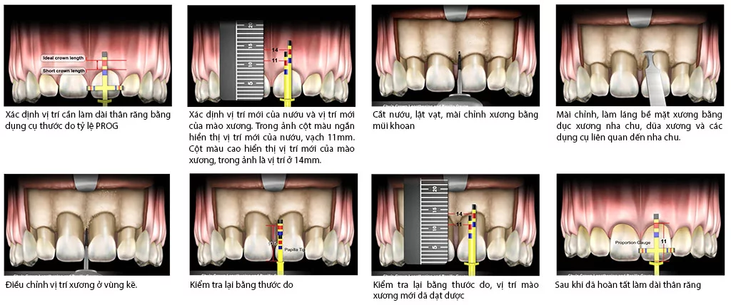 bộ dụng cụ thước đo thẩm mỹ của dr. chu 9 thuoc do tham my dr chu 8