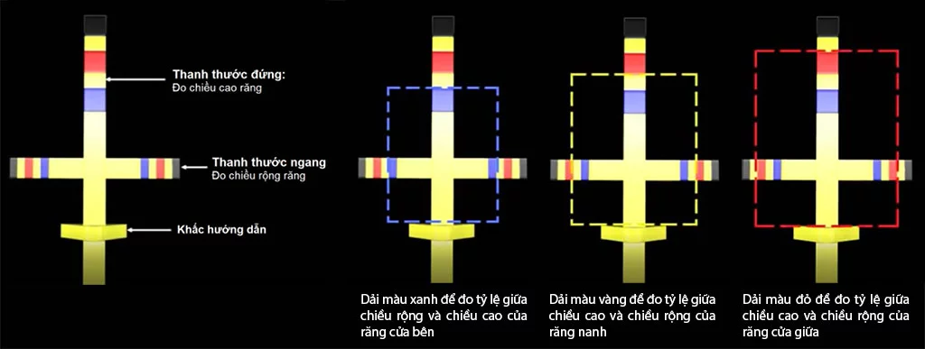 bộ dụng cụ thước đo thẩm mỹ của dr. chu 4 thuoc-do-ty-le-can-xung-than-rang-dr.-chu-t-bar-3-1