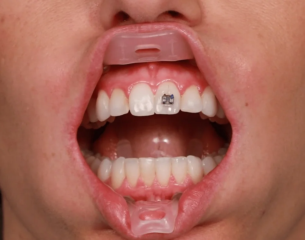 banh miệng đa năng umbrella - ảnh 6