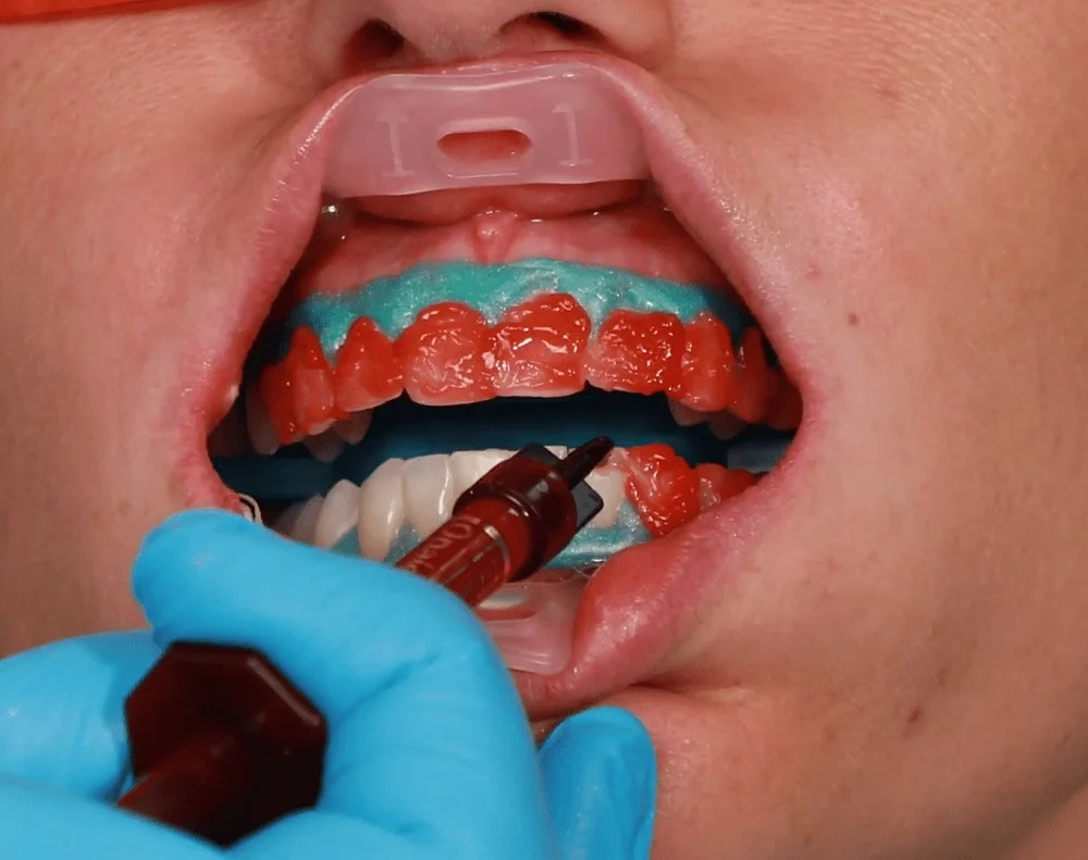 banh miệng đa năng umbrella - ảnh 4