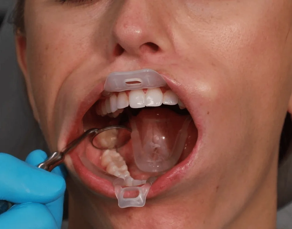 banh miệng đa năng umbrella - ảnh 3