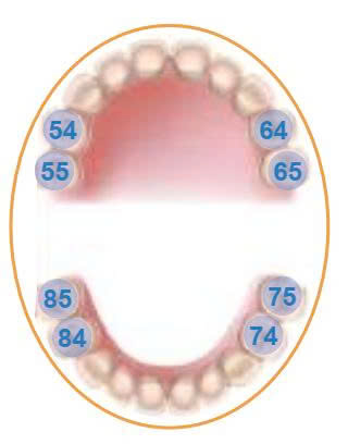 zirconia crown so do rang