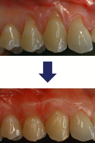 hội nghị zimvie lmplantology days asia edition 2025 3 zimvie implantology days 2025