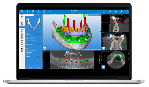 hội nghị zimvie lmplantology days asia edition 2025 5 nang tam kien thuc cay ghep implant cung zimvie implantology days 1
