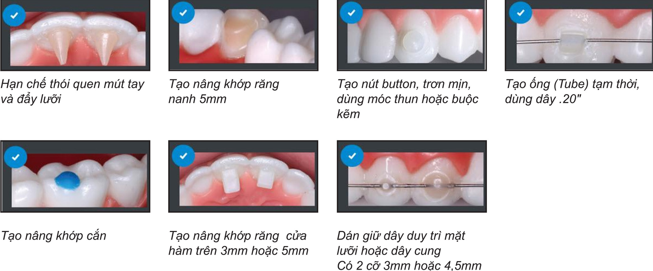 bộ khuôn tạo hình đa năng reliamold kit 4 hình ảnh thực tế công dụng relianmold kit