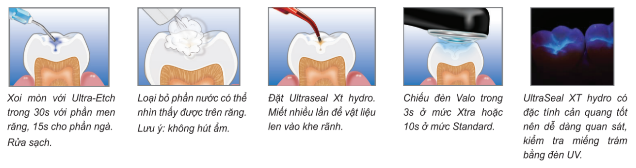 đặt sealant đúng cách với ultraseal xt hydro 1 hướng dẫn đặt sealant đúng cách với ultraseal xt hydro