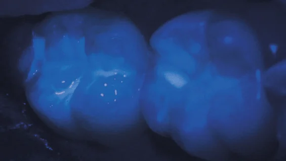 đặt sealant đúng cách với ultraseal xt hydro 2 ultraseal xt hydro cho phép quan sát rõ dưới ánh sáng đen (black light).