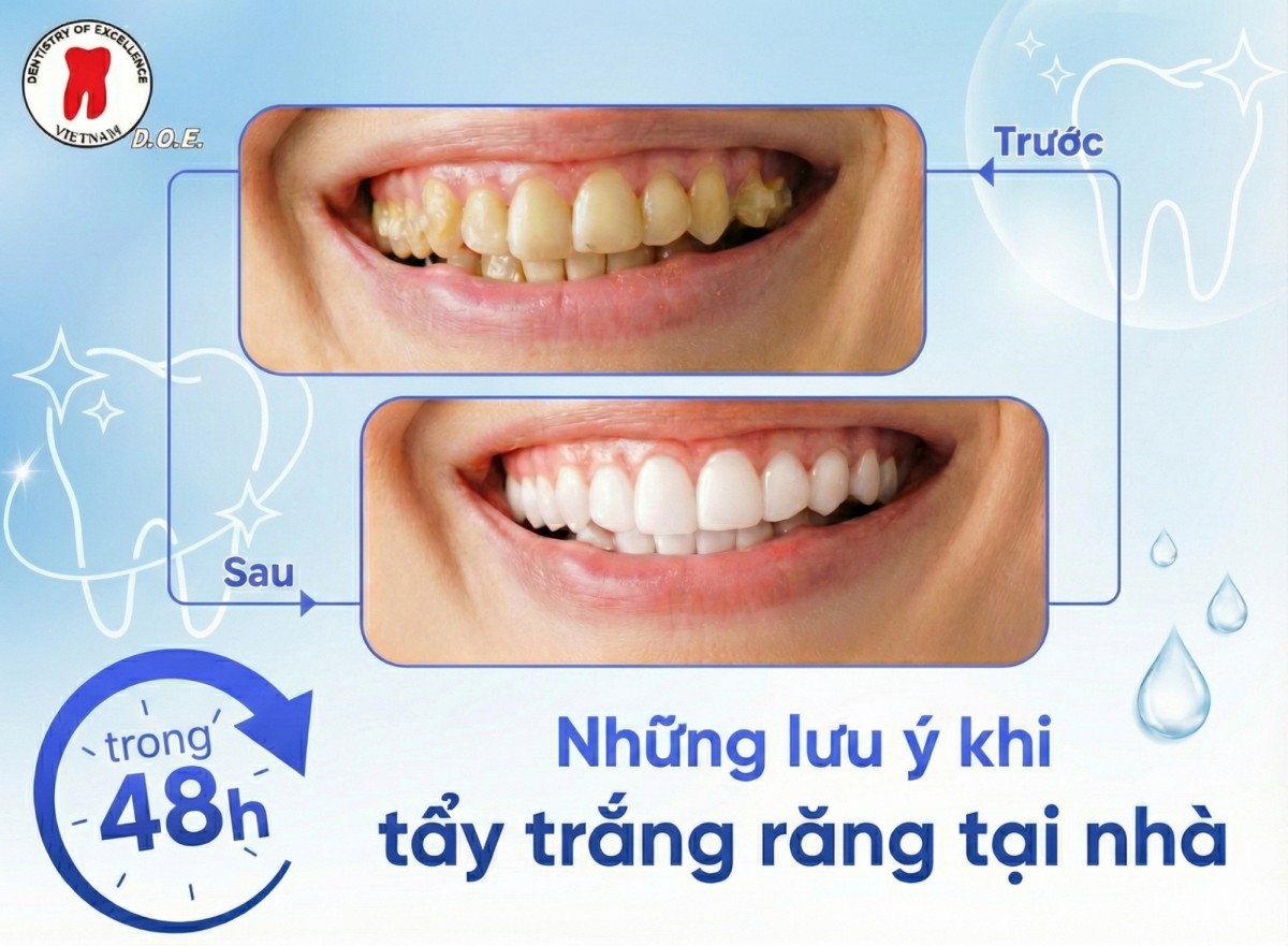 top 5 cách tẩy trắng răng tại nhà hiệu quả và an toàn nhất 4 tẩy trắng răng tại nhà đúng cách – trắng sạch không tì vết.