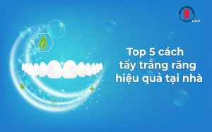 top 5 cách tẩy trắng răng tại nhà hiệu quả và an toàn nhất