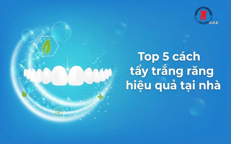 Top 5 cách tẩy trắng răng tại nhà hiệu quả và an toàn nhất