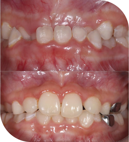 lop dtlt thuc hanh nha khoa tre em khoa 9 hinh lam san