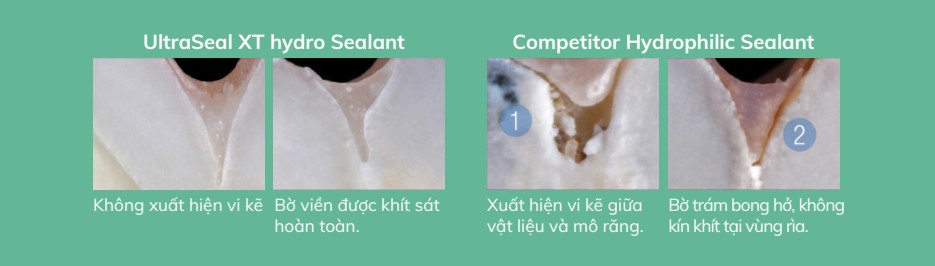 so sanh ultraseal xt hydro va clinpro 3m sealant nao tot hon 1
