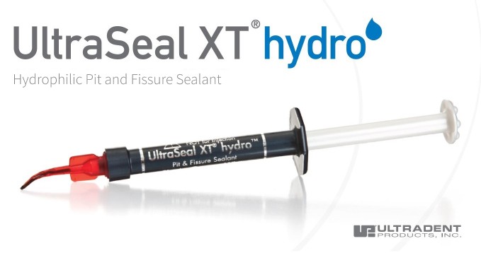 so sanh ultraseal xt hydro va clinpro 3m sealant nao tot hon 2