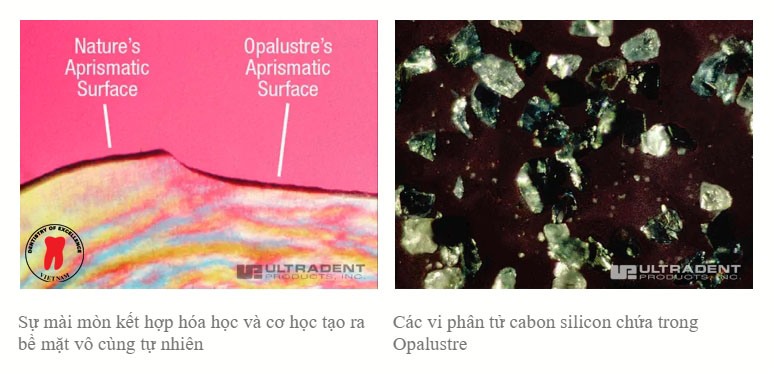 điều trị đốm trắng - dr. renato miotto palo, dds 3 đặc điểm opalustre