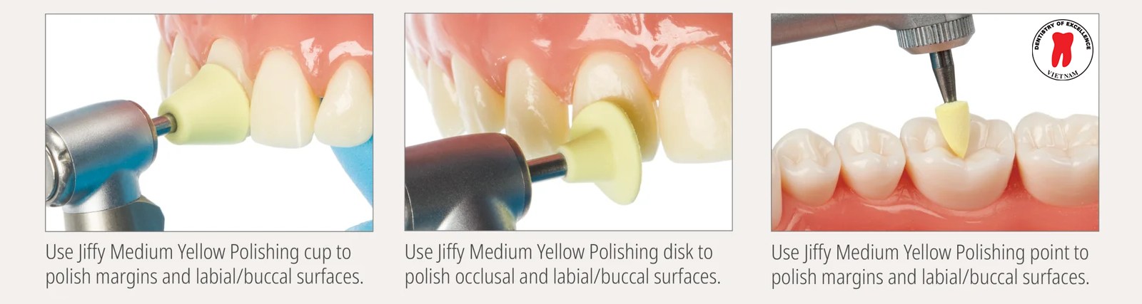 hướng dẫn từng bước để đạt bề mặt hoàn thiện tối ưu 1