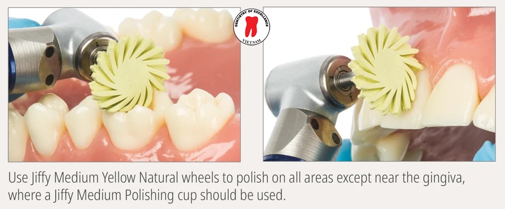 hướng dẫn từng bước để đạt bề mặt hoàn thiện tối ưu 4