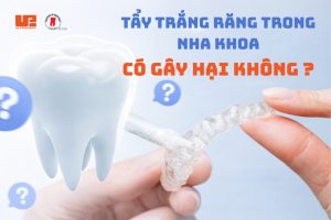 TẨY TRẮNG RĂNG TRONG NHA KHOA CÓ GÂY HẠI KHÔNG?