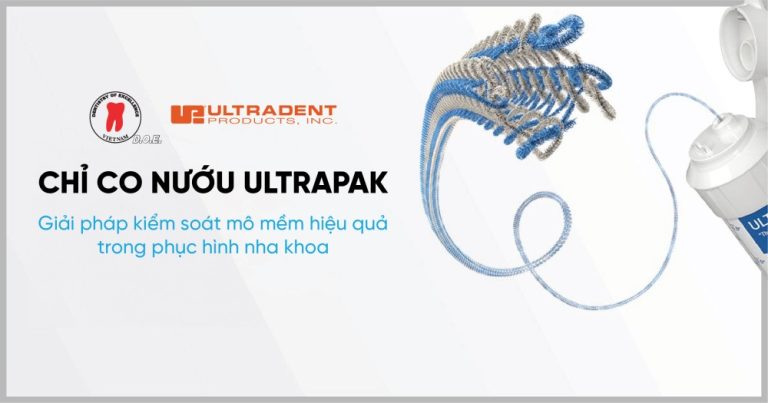 trang chủ 86 banner chi co nuou ultrapak giai phap kiem soat mo mem hieu qua trong phuc hinh nha khoa
