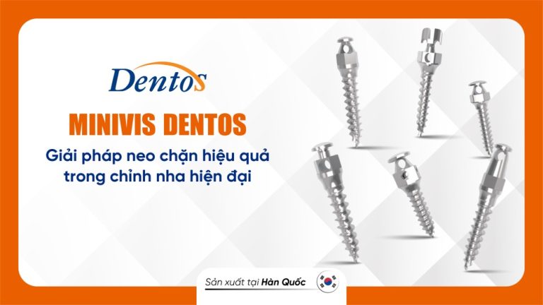 minivis dentos– giải pháp neo chặn hiệu quả trong chỉnh nha hiện đại