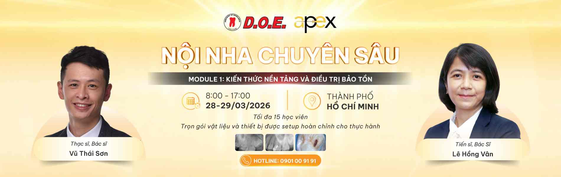noi nha chuyen sau banner