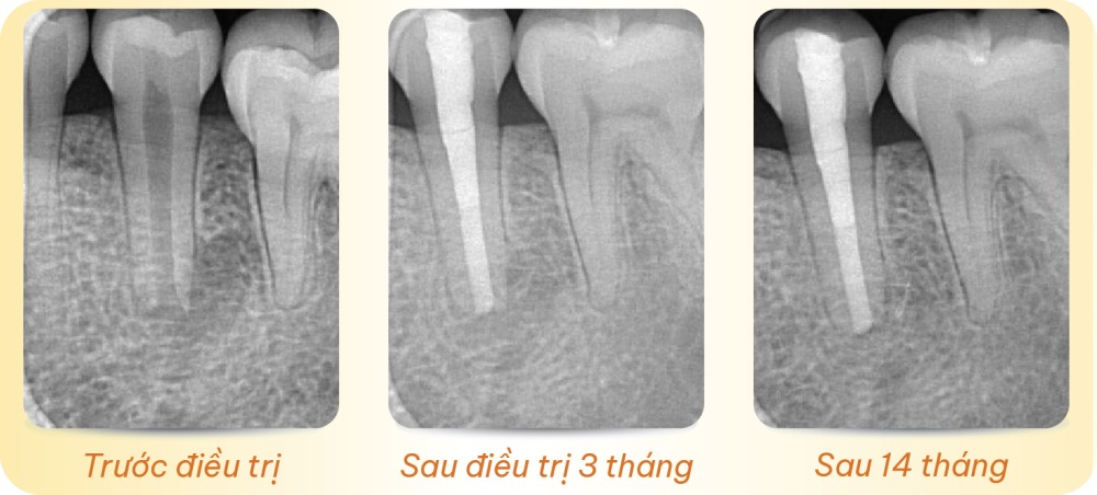 noi nha chuyen sau module 2 1