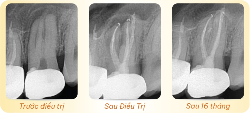 noi nha chuyen sau module 2 2