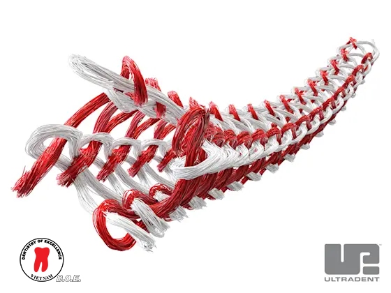 ưu điểm nổi bật của chỉ banh nướu ultrapak