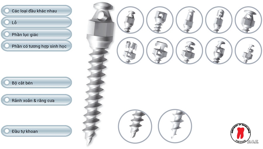 minivis dentos– giải pháp neo chặn hiệu quả trong chỉnh nha hiện đại 2 minivis của hãng dentos
