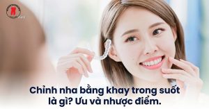 Chỉnh nha bằng khay trong suốt là gì? Ưu và nhược điểm