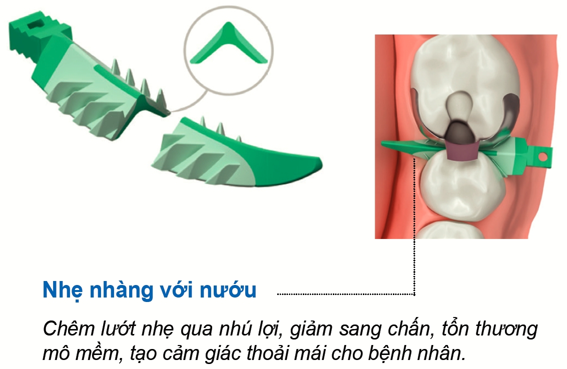 strata g interproximal wedge refills mieng chem 1