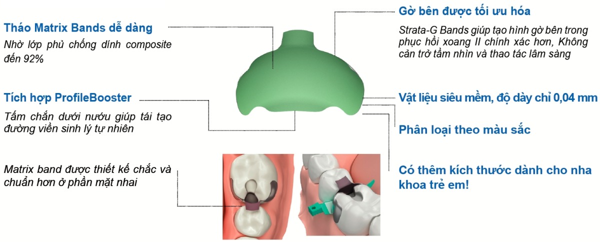 strata g matrix bands khuon tram xoang ii 2