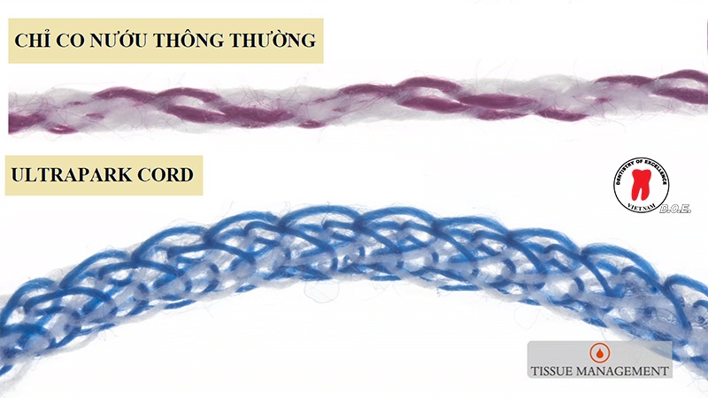 chi co nuou ultrapak cord ultradent 4