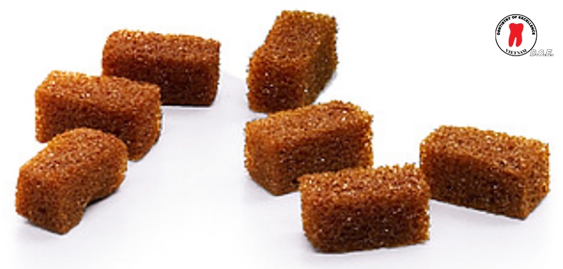 gelatamp roeko giai phap vang kiem soat cam mau 3