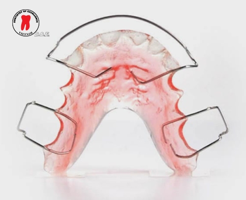 hàm duy trì sau chỉnh nha: phân loại, thời gian đeo và cách vệ sinh. 2 ham duy tri sau chinh nha phan loai thoi gian deo va cach ve sinh 3