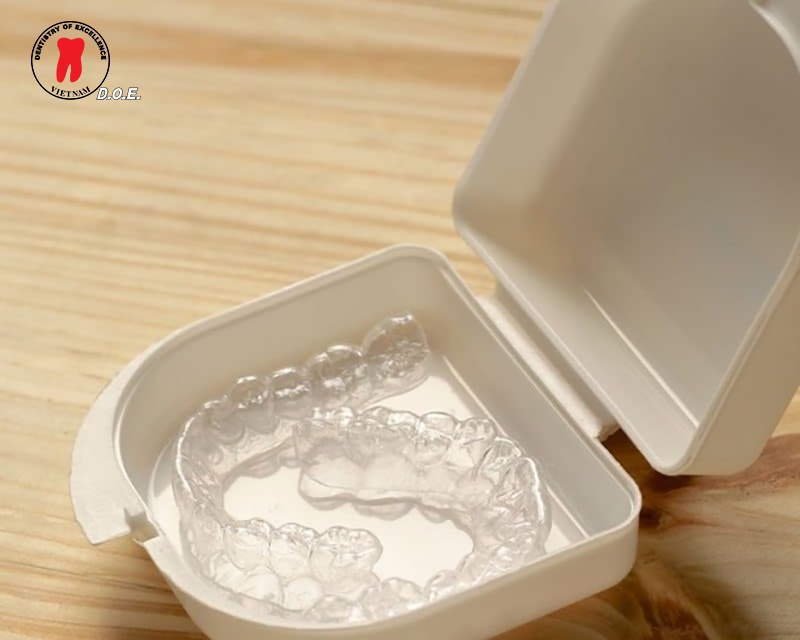 hàm duy trì sau chỉnh nha: phân loại, thời gian đeo và cách vệ sinh. 5 ham duy tri sau chinh nha phan loai thoi gian deo va cach ve sinh 5