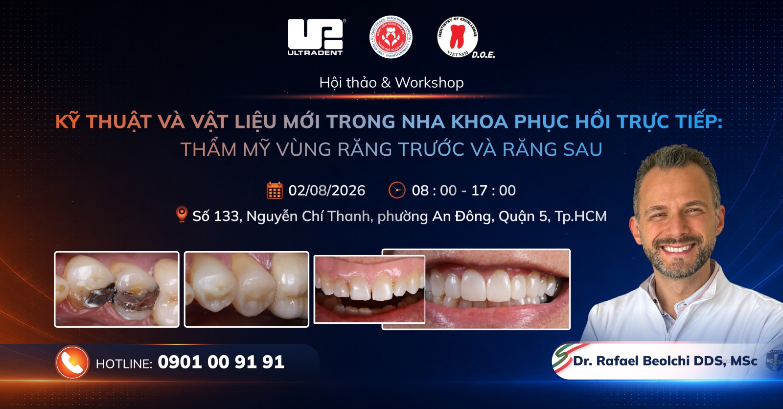 đèn quang trùng hợp có thể giúp kéo dài tuổi thọ phục hồi như thế nào? 12 den quang trung hop co the giup keo dai tuoi tho phuc hoi nhu the nao 124