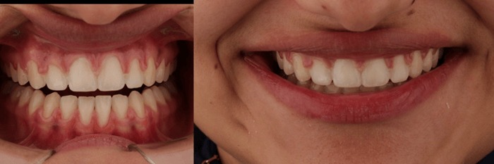 hình 4: mock-up