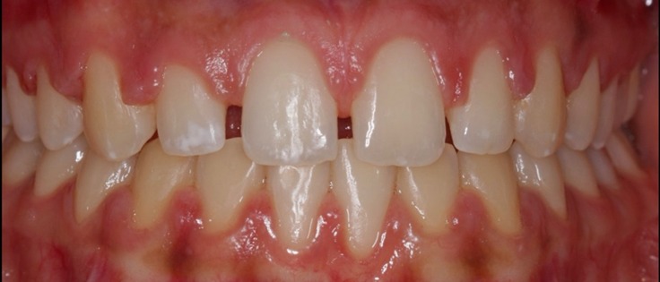 hình 2: tình trạng ban đầu.