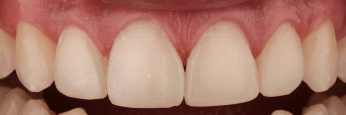 hình 11: kết quả cuối cùng: ảnh chụp cận cảnh 